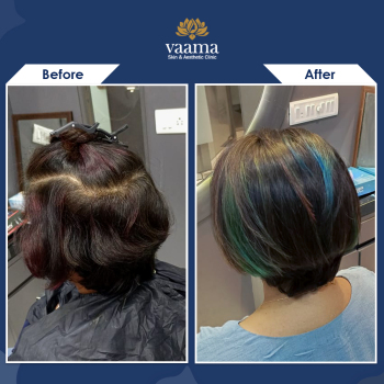 Before-After-Salon-02