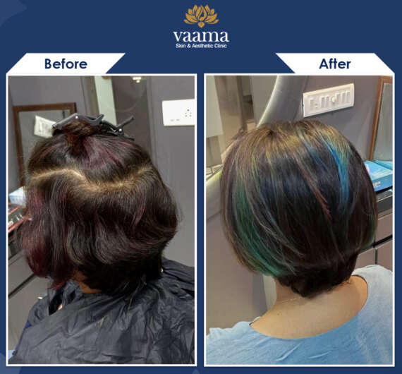 Before-After-Salon-02